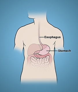 Upper Gastrointestinal Diseases